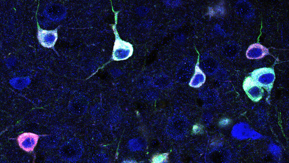 Image of mouse primary visual cortex showing GABAergic interneurons (blue) expressing two halves (red and green) of a healthy SCN1A protein,