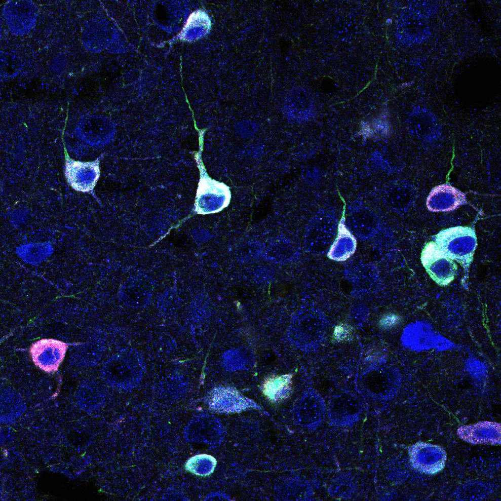 Image of mouse primary visual cortex showing GABAergic interneurons (blue) expressing two halves (red and green) of a healthy SCN1A protein,