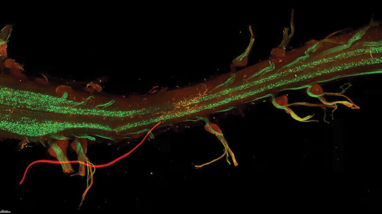 spinal motor neurons in green and red