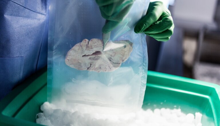 A scientist handles frozen brain tissue