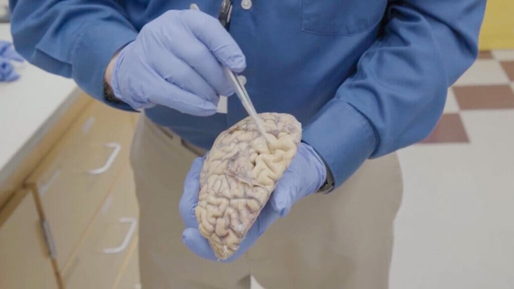 Researcher holding human brain