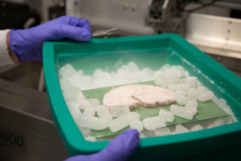 scientist with purple latex gloves has a human brain sample in a green container surrounded by dry ice