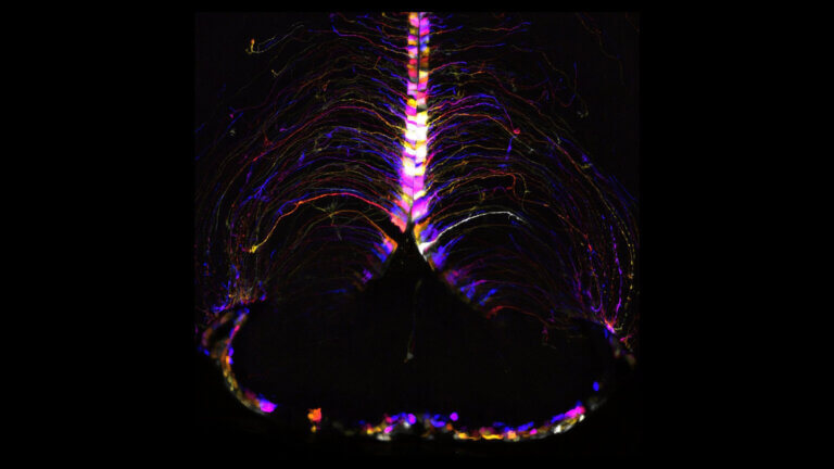 Mouse aging brain cells illuminated