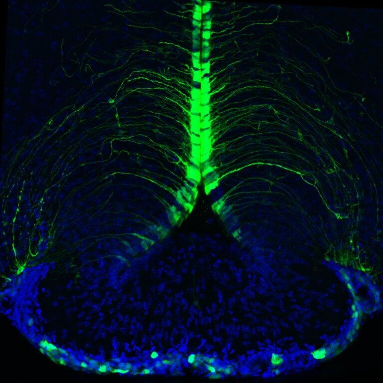 This image shows non -neuronal brain cells called tanycytes, are illuminated and color coded according to their depth, in the hypothalamus brain of a mouse. They are one of the c ell types in the mouse brain that show a large number of gene transcripts changing with age.