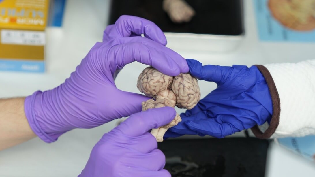 Gloved hands holding a sheep brain