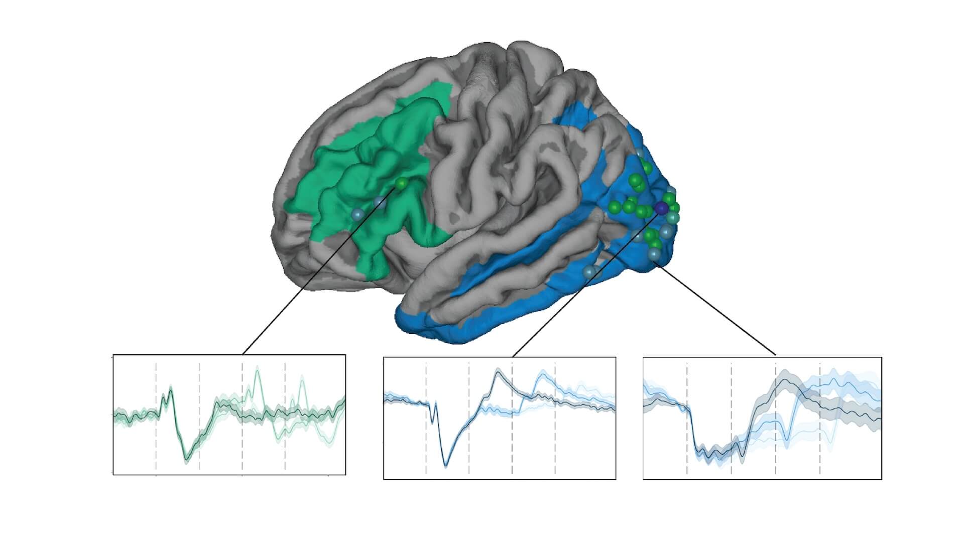brain with different colored regions and graphs showing activity