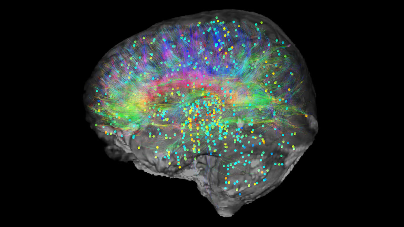 visualization of a brain colorful streamlines and dots