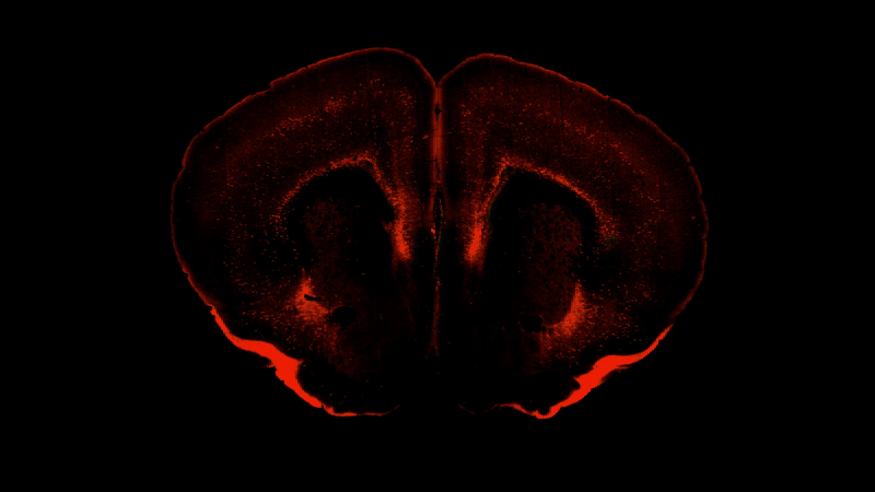 Different populations of cells in the mouse brain, each one targeted with high specificity by one of the many new genetic tools developed at the Allen Institute. 