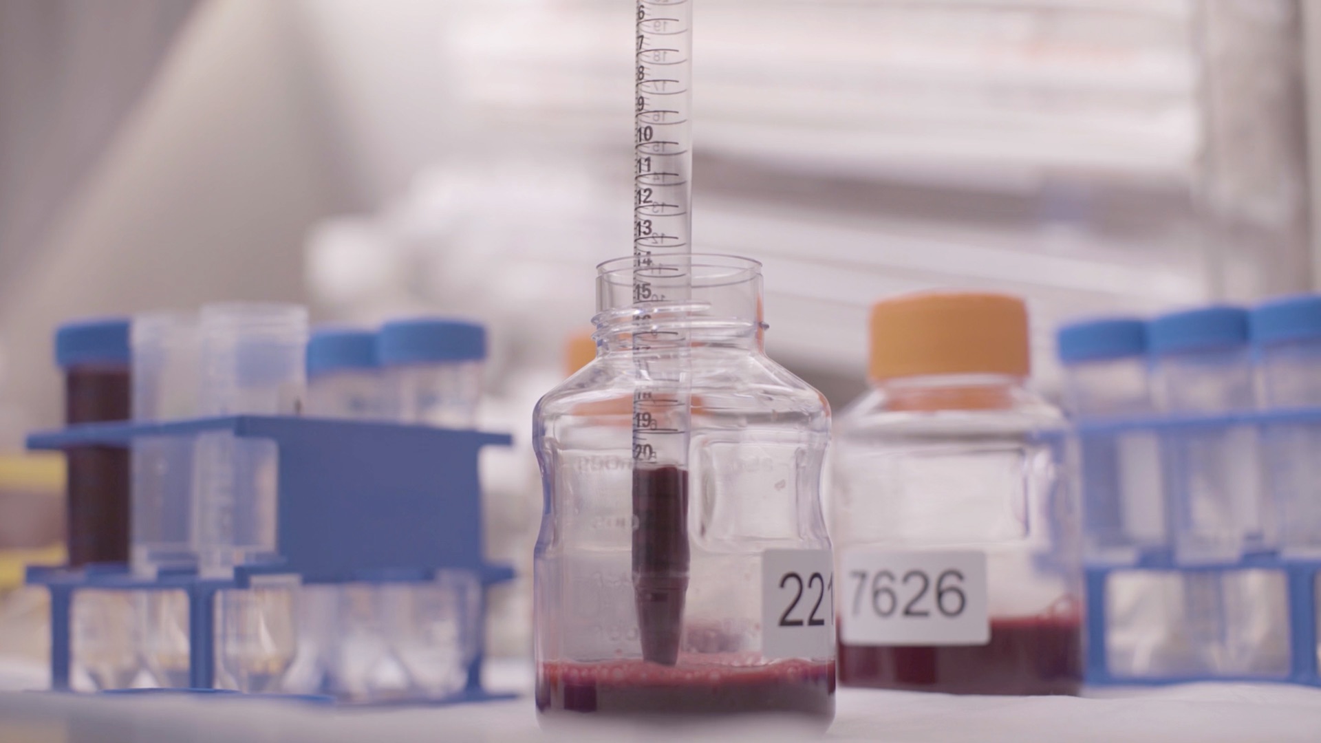 Image of blood samples being processed in the lab