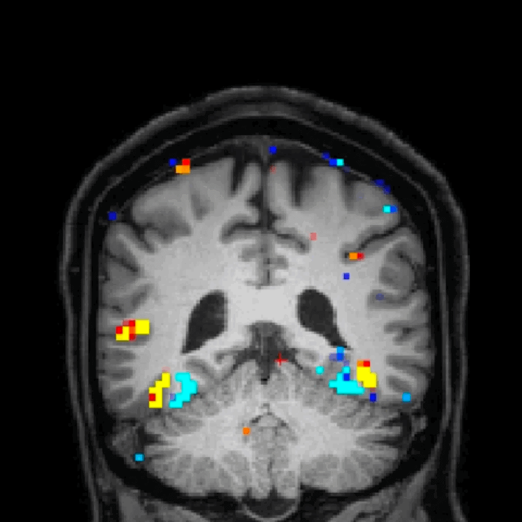 FMRI Brain Map Study