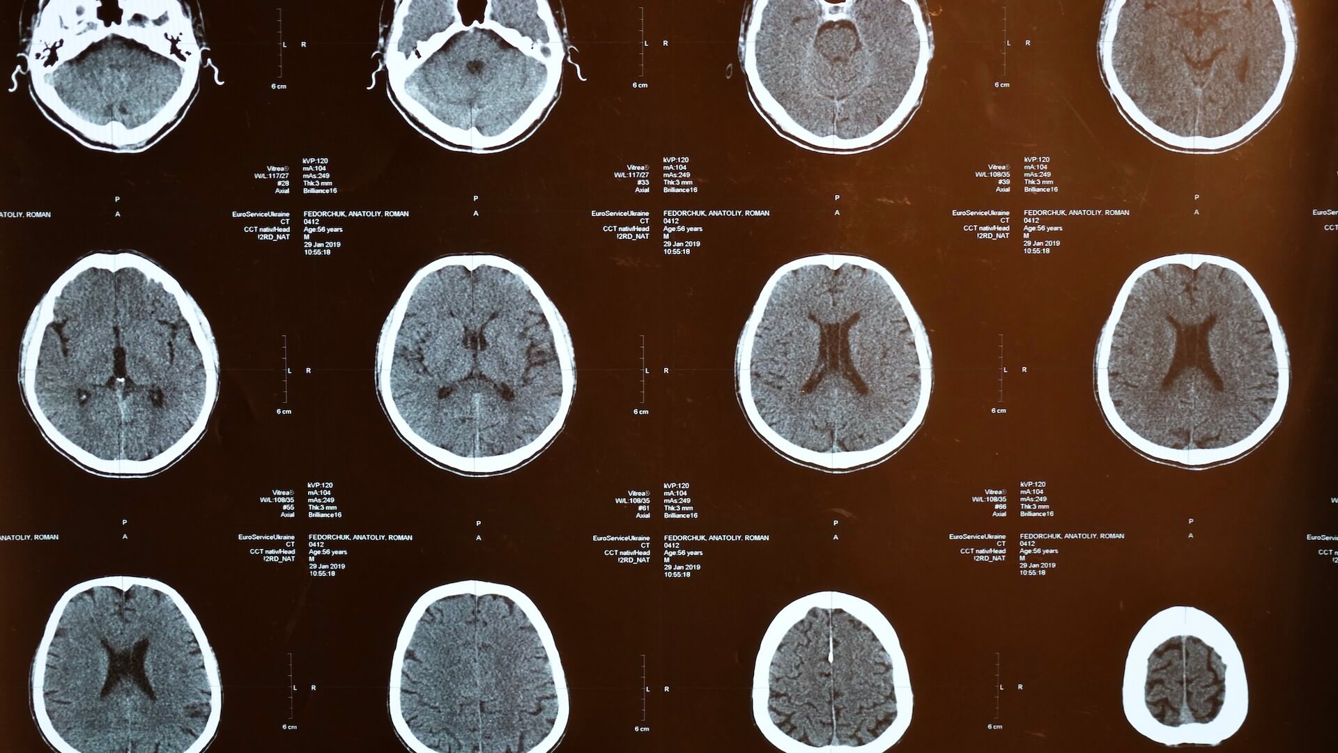 http://MRI%20image%20of%20human%20brain%20from%20stock%20imagery.