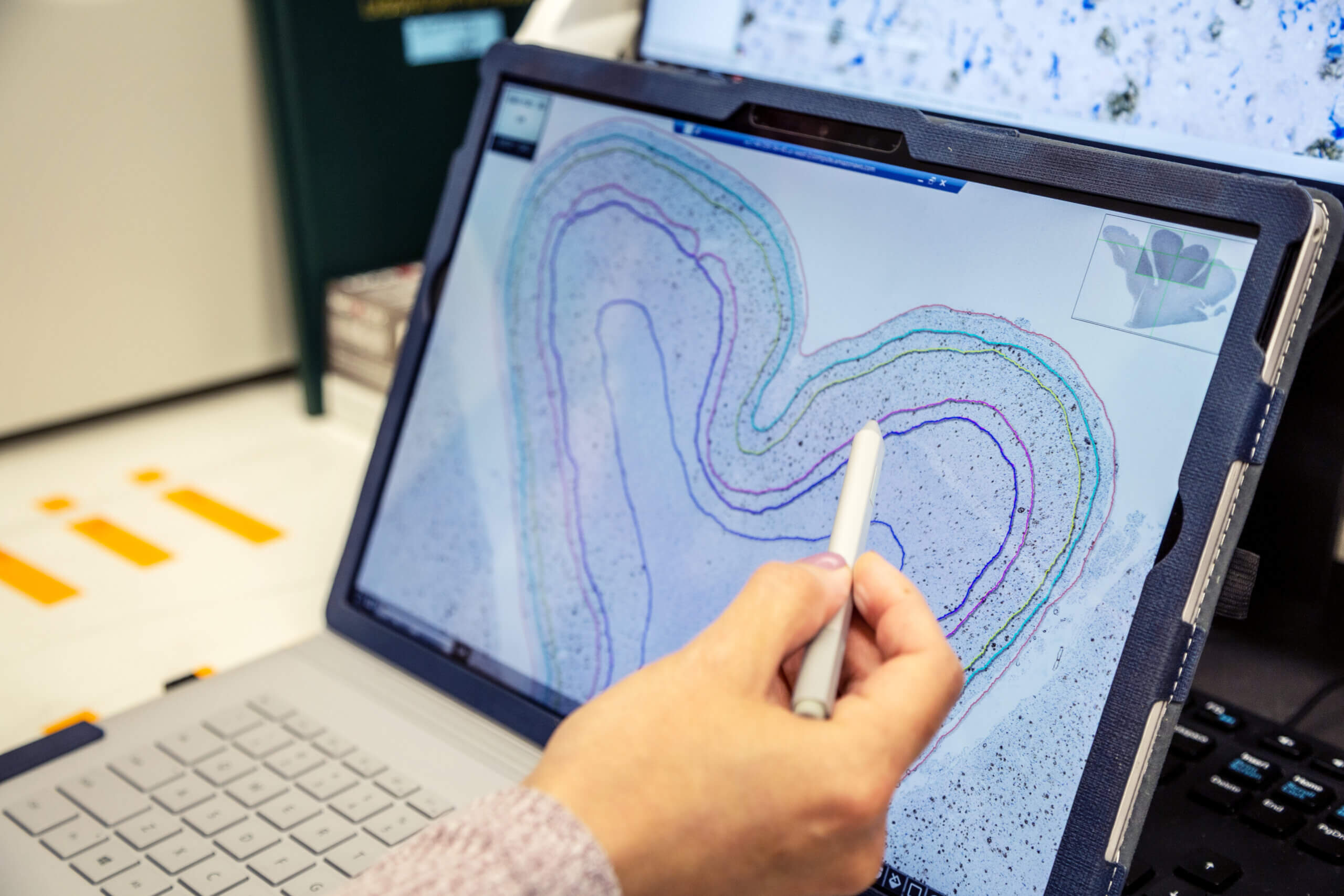 scientist pointing at screen showing brain slice