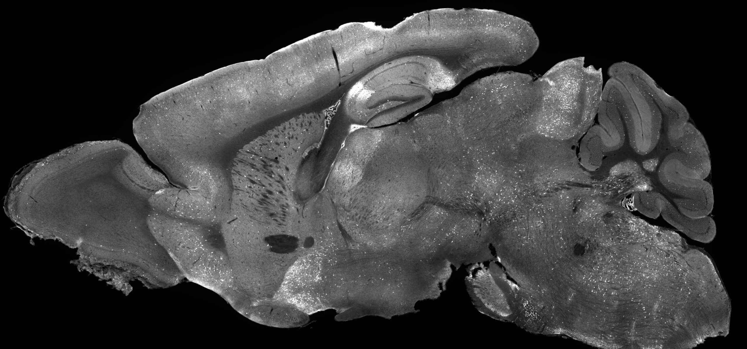 Black and white image of brain slice from a mouse brain