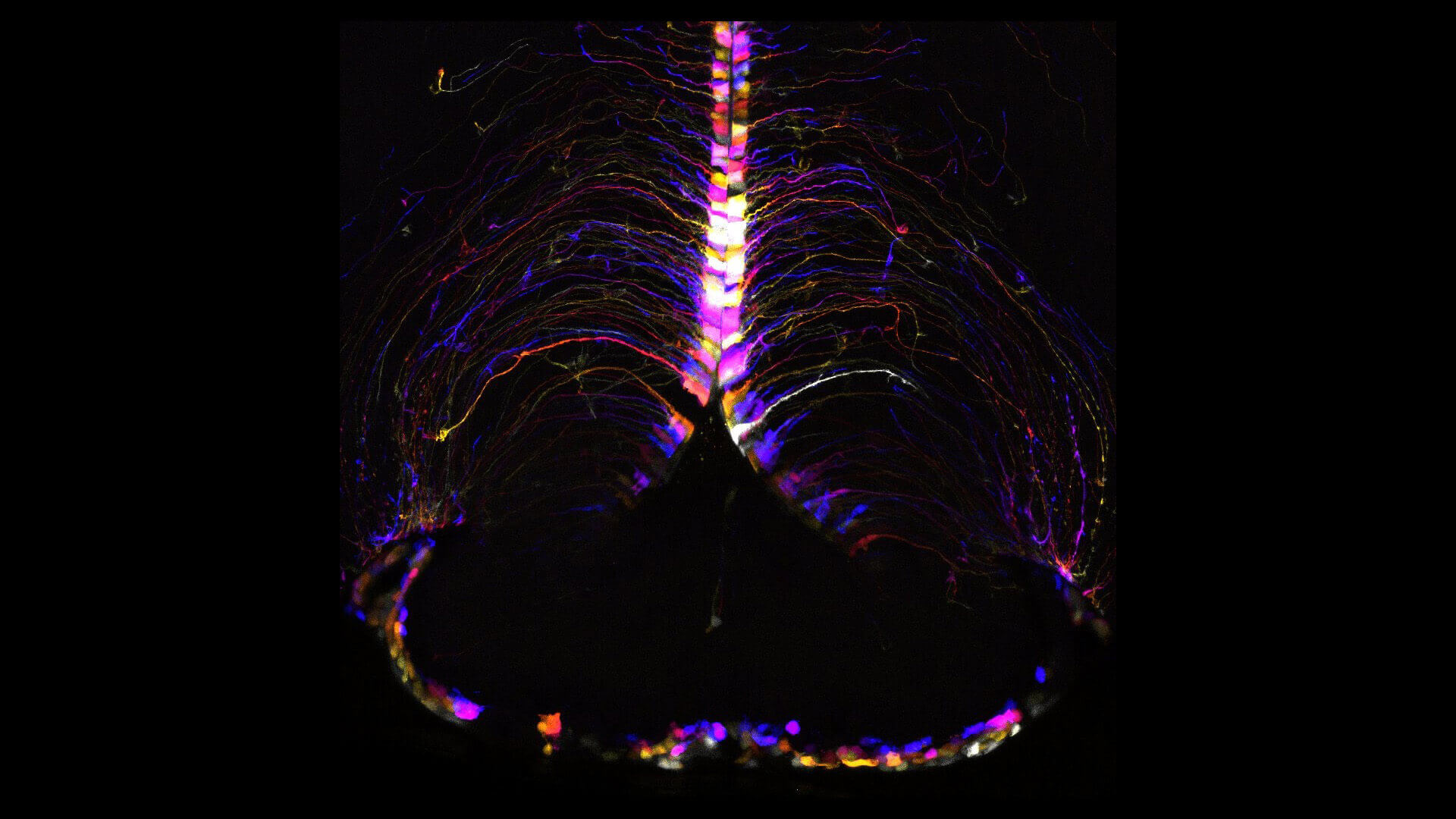 highlighted mouse brain